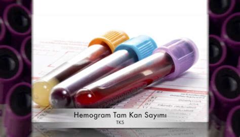 Hemogram Testi Niçin Yapılır?